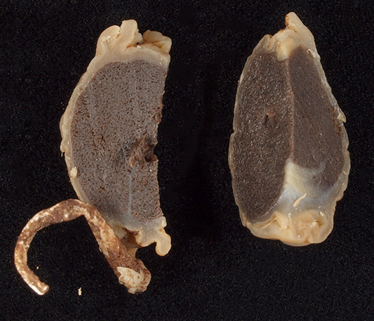 ハハシマアコウショウロ